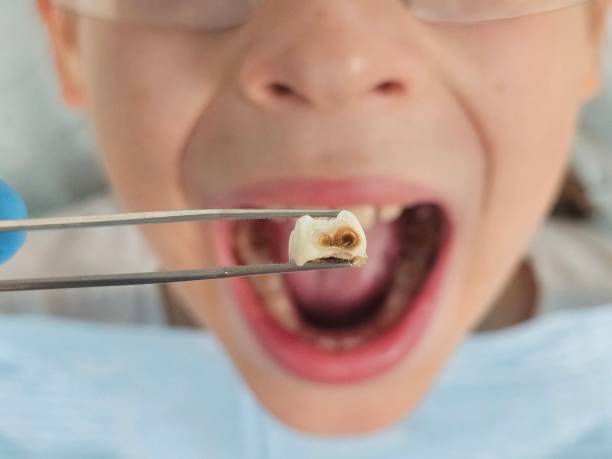 Best Emergency Broken Tooth Repair in Edgewater, MD