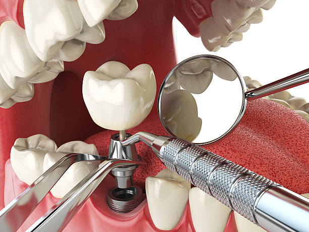 Best Emergency Treatment for Toothache in Edgewater, MD